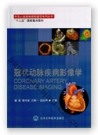冠状动脉疾病影像学